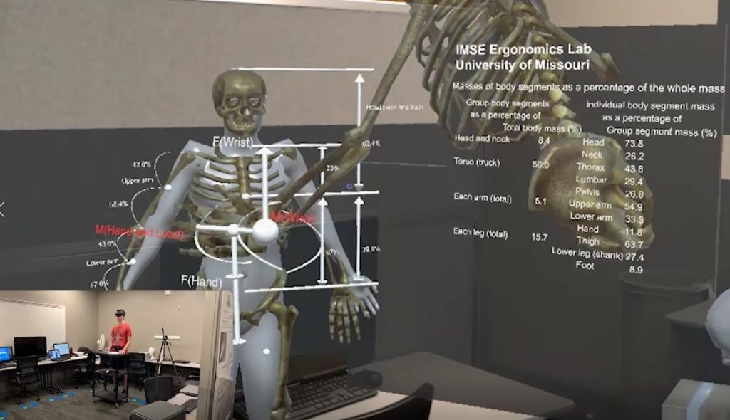 Image of augmented skeletal system.