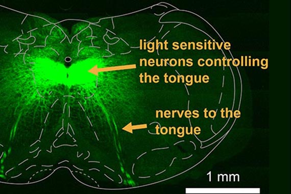 brainfeature